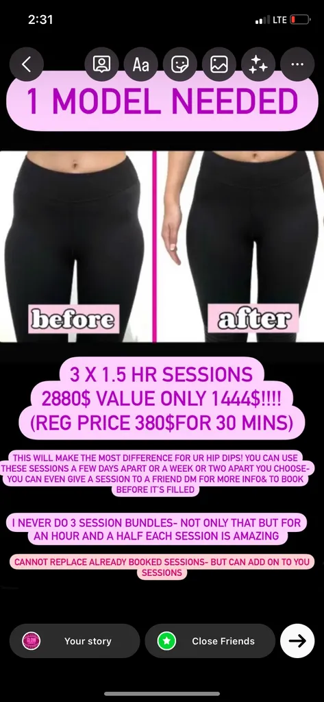 Hip dips? Come for hip plumping treatment photo 1