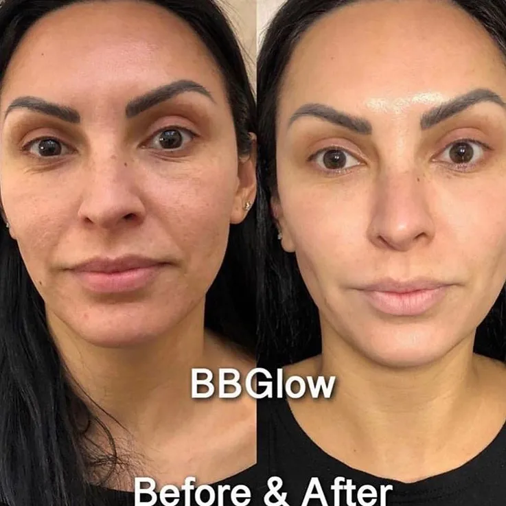 BB Glow Models needed ✨  photo 1