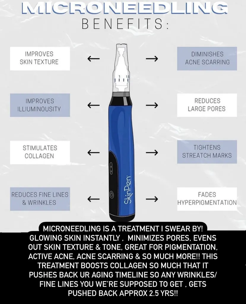 Microneedling models needed photo 1