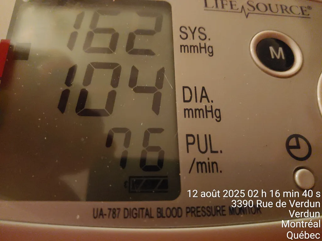 2 blood pressure machine  photo 1